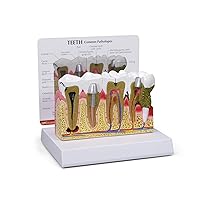 Vista 1 de GPI Anatomicals - Modelo de anatomía de dientes humanos con problemas dentales comunes, réplica para la educación en anatomía y fisiología