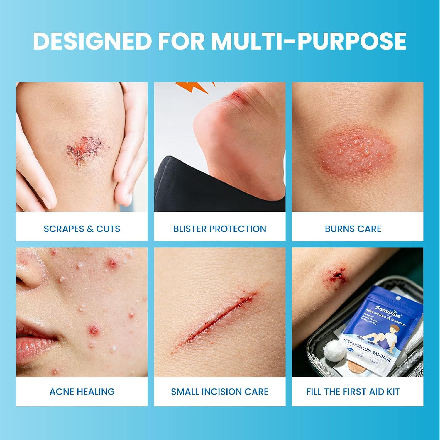 Hydrocolloid Bandages, Help Reduce Scab Formation, Waterproof and Healing-Promoting, Box of 11