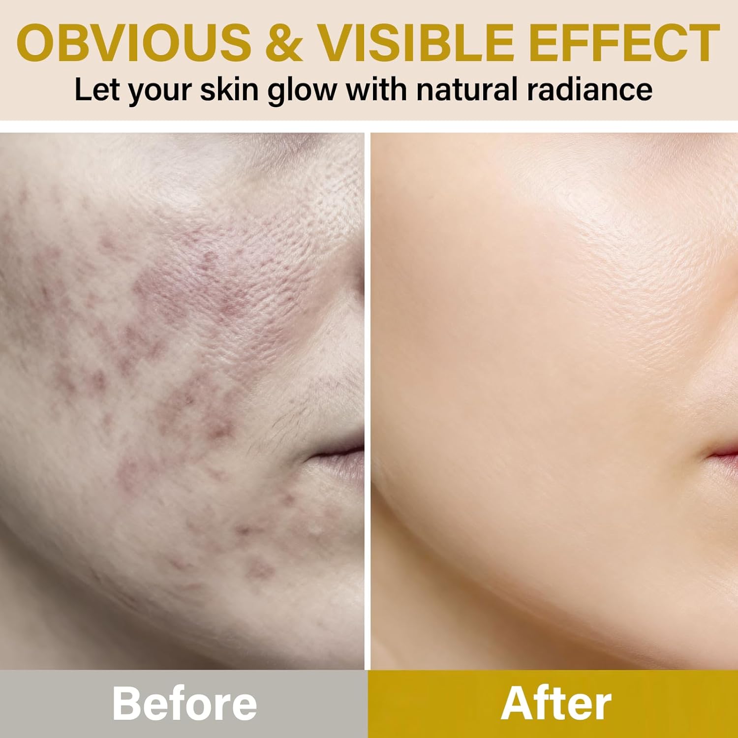 Bee Venom Cream- Anti-Aging Face Cream with Bee Venom, Instantly Lifts & Firms Skin, Reduces Wrinkles & Fine Lines, Natural Bee Venom Skin Treatment for All Skin Types - Image 5