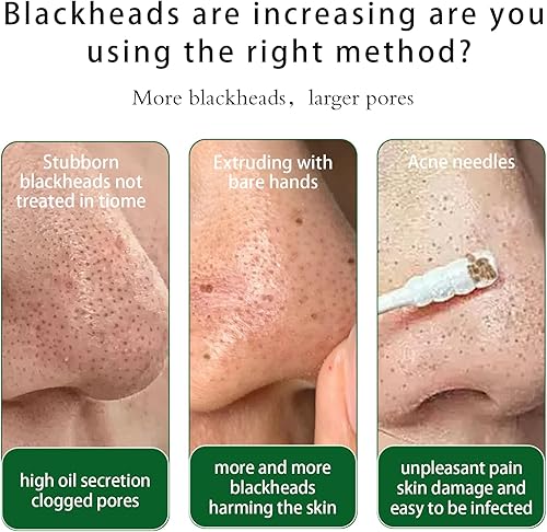Miniatura 5 de Lmported - Tiras de eliminación de acné de puntos negros, control de aceite, tiras de nariz, desatascamiento instantáneo de poros, encogimiento de