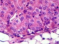 Review Image by RH RH