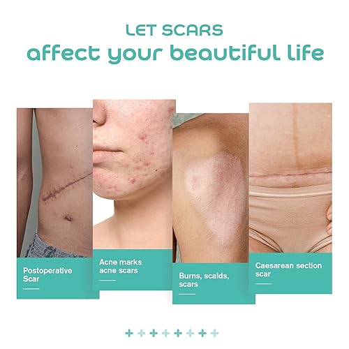 Miniatura 4 de YRVHCK Cinta de silicona suave de grado médico para eliminación de cicatrices (1 x 120 pulgadas), 1 rollo de 70.9 in con hojas de cicatriz de