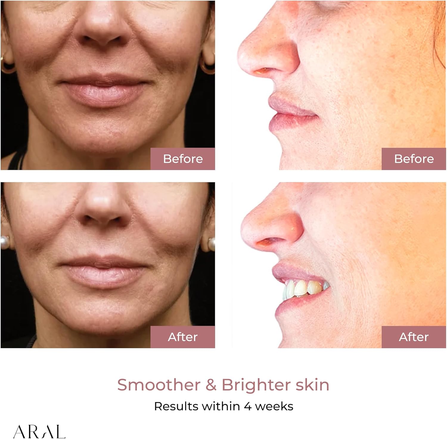 Aura Red Light Facial Mask for Glowing Skin | LED Beauty Device with Multiple Light Modes | Spa-Inspired for Radiant, Youthful-Looking Complexion | Portable & Lightweight