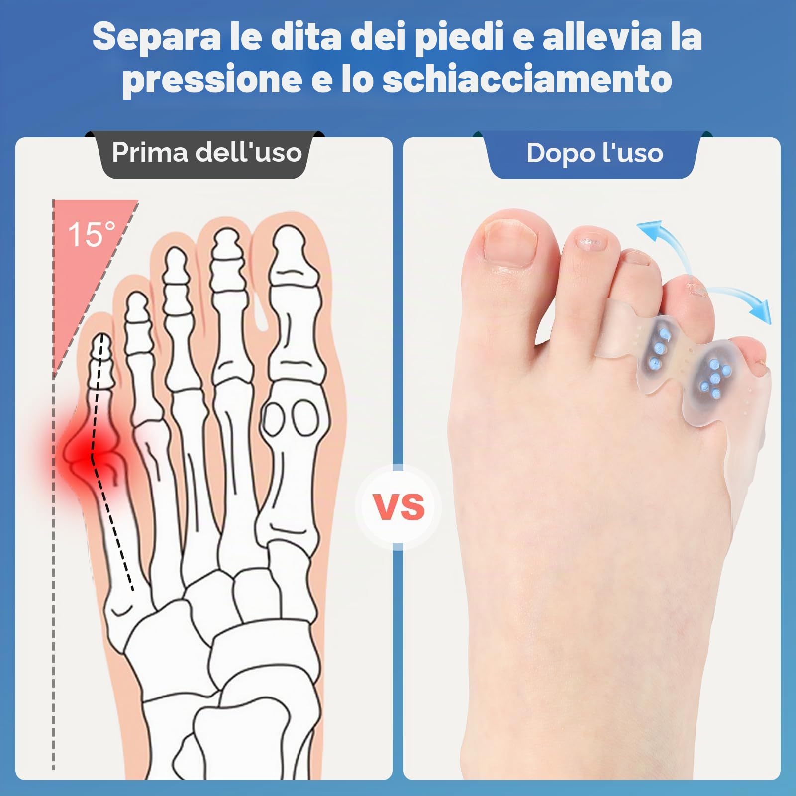 Correttore per alluce valgo e protezione per mignolo – raddrizzatore per dita dei piedi arricciate e storte, separatori per dita sovrapposte, sollievo dal dolore per alluce valgo e mignolo
