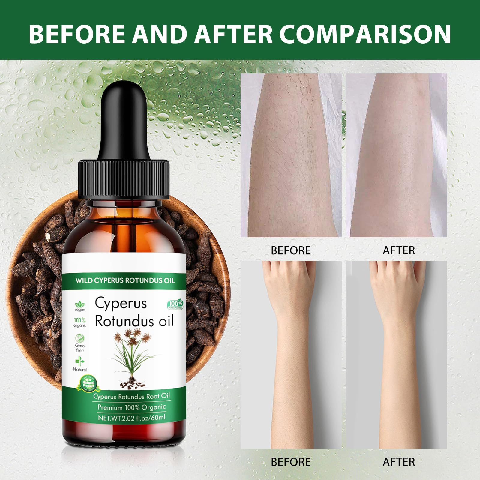 Cyperus Rotundus Oil for Hair Removal, Natural Cyperus Rotundus Oil to Reduce Body Hair Growth - Image 2