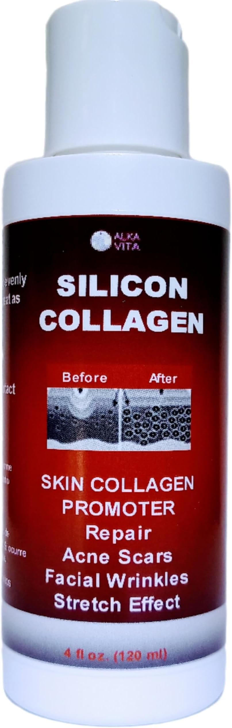 Acne Scars Silicon and Collagen Hydrolyzed Facial Gel Skin Resurfacing Indented By ALKA VITA