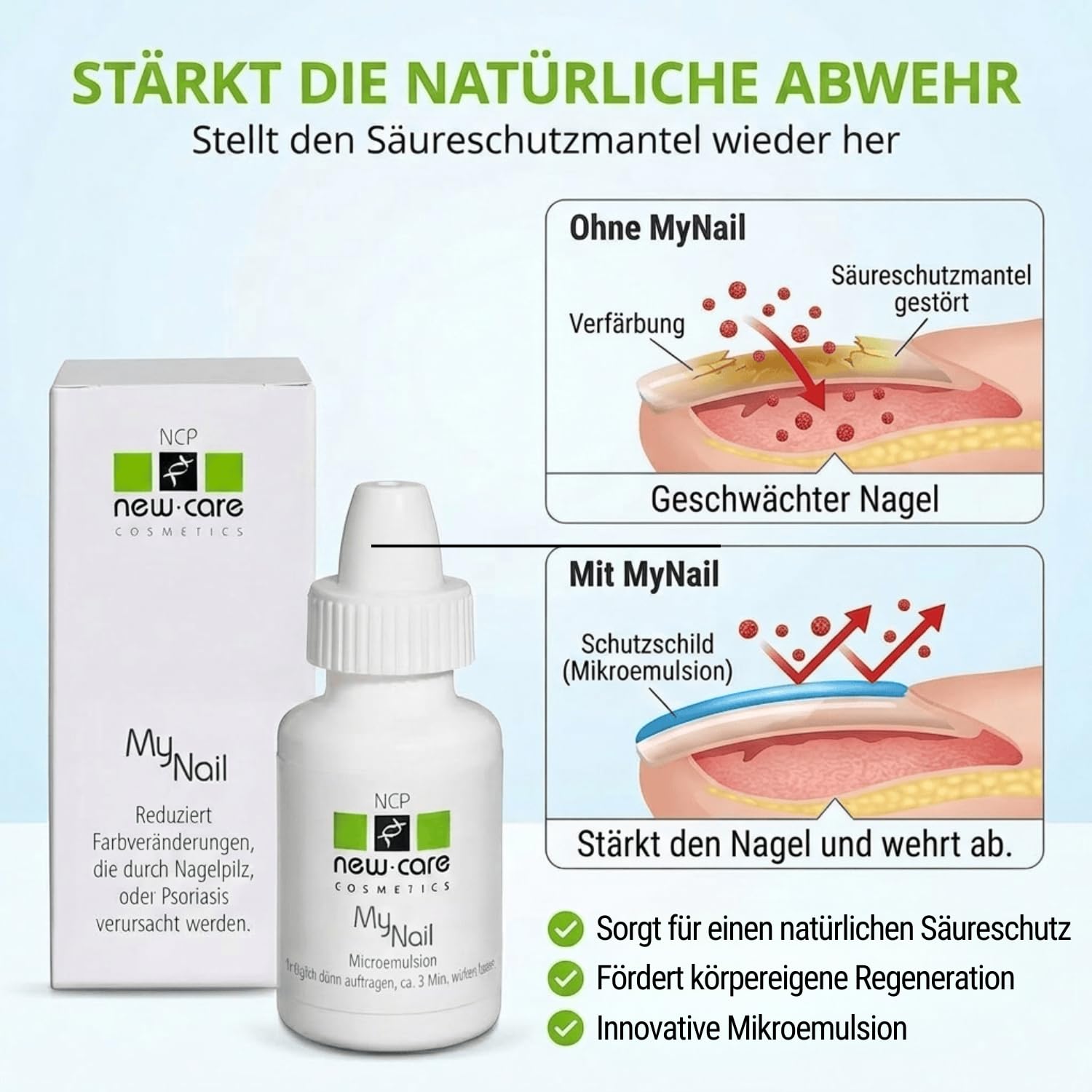 MyNail Nagelserum - 10 ml – Nagelkur, bei Nagelpilz und gegen brüchige Nägel - ohne Feilen - Nagelpflege, Nagelhärter zur Wiederherstellung schöner und glänzender Nägel