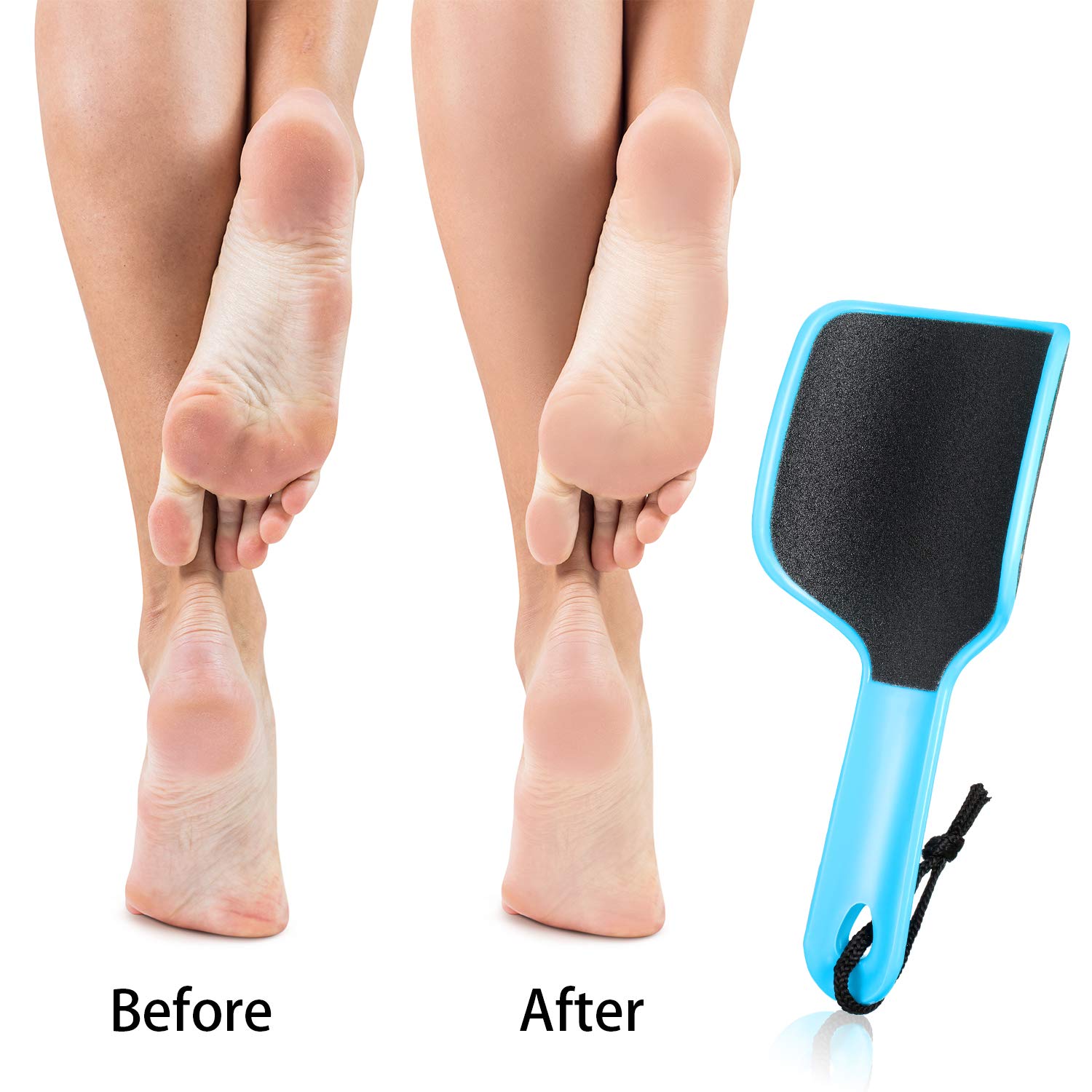 4 piezas de lima curvada en forma de U, removedor de callos de pie de doble cara, colosal para grano, exfolia elimina la piel muerta, 4 colores 6