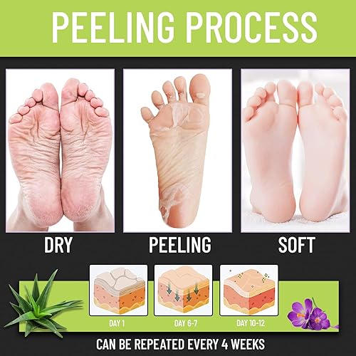 Miniatura 3 de VALITIC Mascarilla exfoliante para pies secos agrietados y eliminación de callos de piel muerta - Vitamina E y Aloe Vera colágeno hidratante