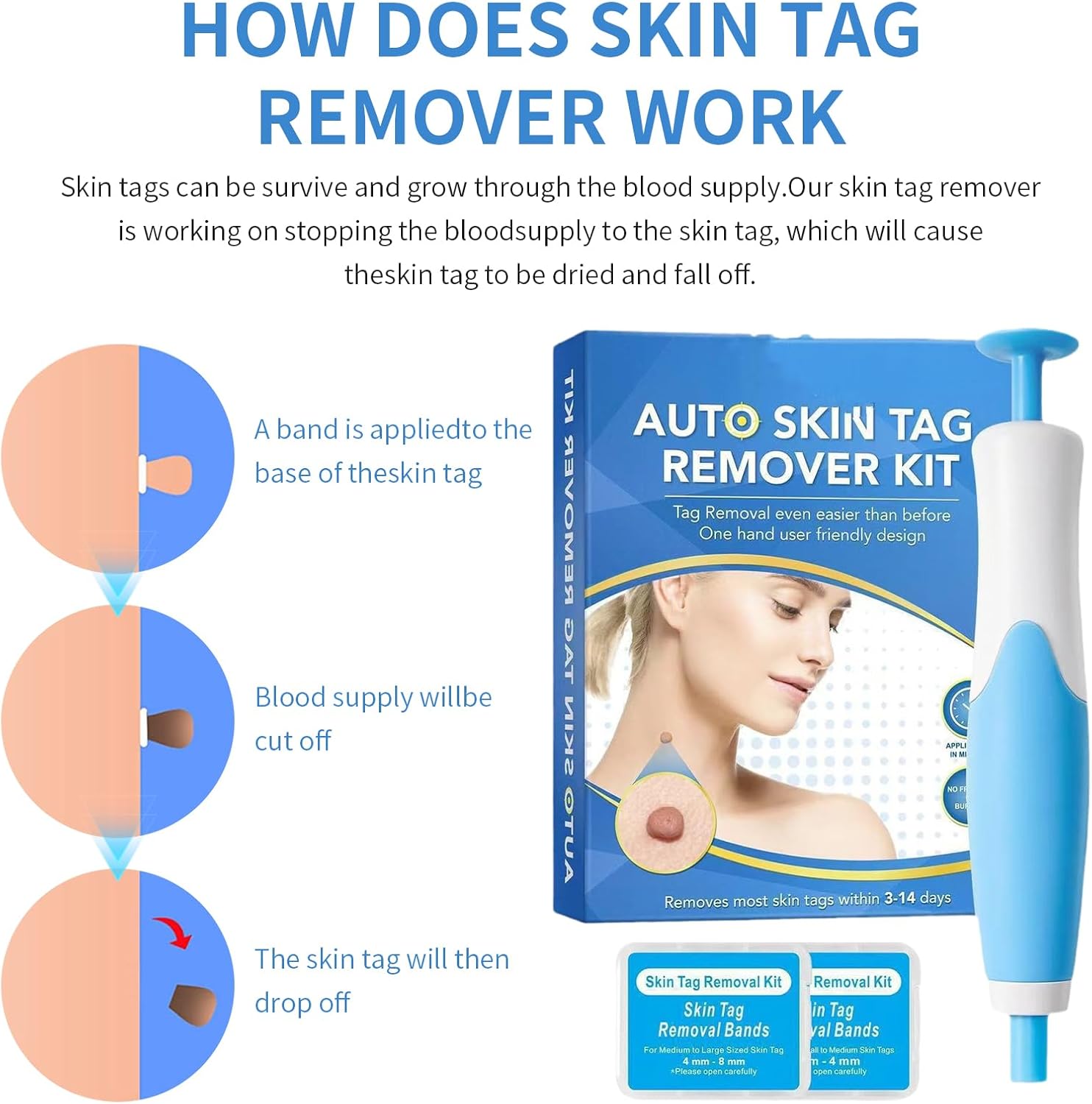 Skin Tag Removal Kit, Upgraded Fast and Easy Removal Pen with 40 Bands, Painless & Fast-Acting Removal for Small to Large Skin Tags (2mm-8.5mm), Effective Wart Remover for Face, Neck & Body Use 5 718zhkOyn9L. AC SL1500