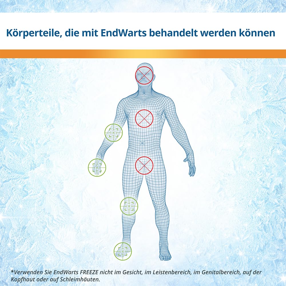 EndWarts FREEZE: Warzen & Dornwarzen behandeln, Vereisungsmittel zur Behandlung von Stielwarzen an Händen, Armen & Füßen, 7-Einweg-Spitzen