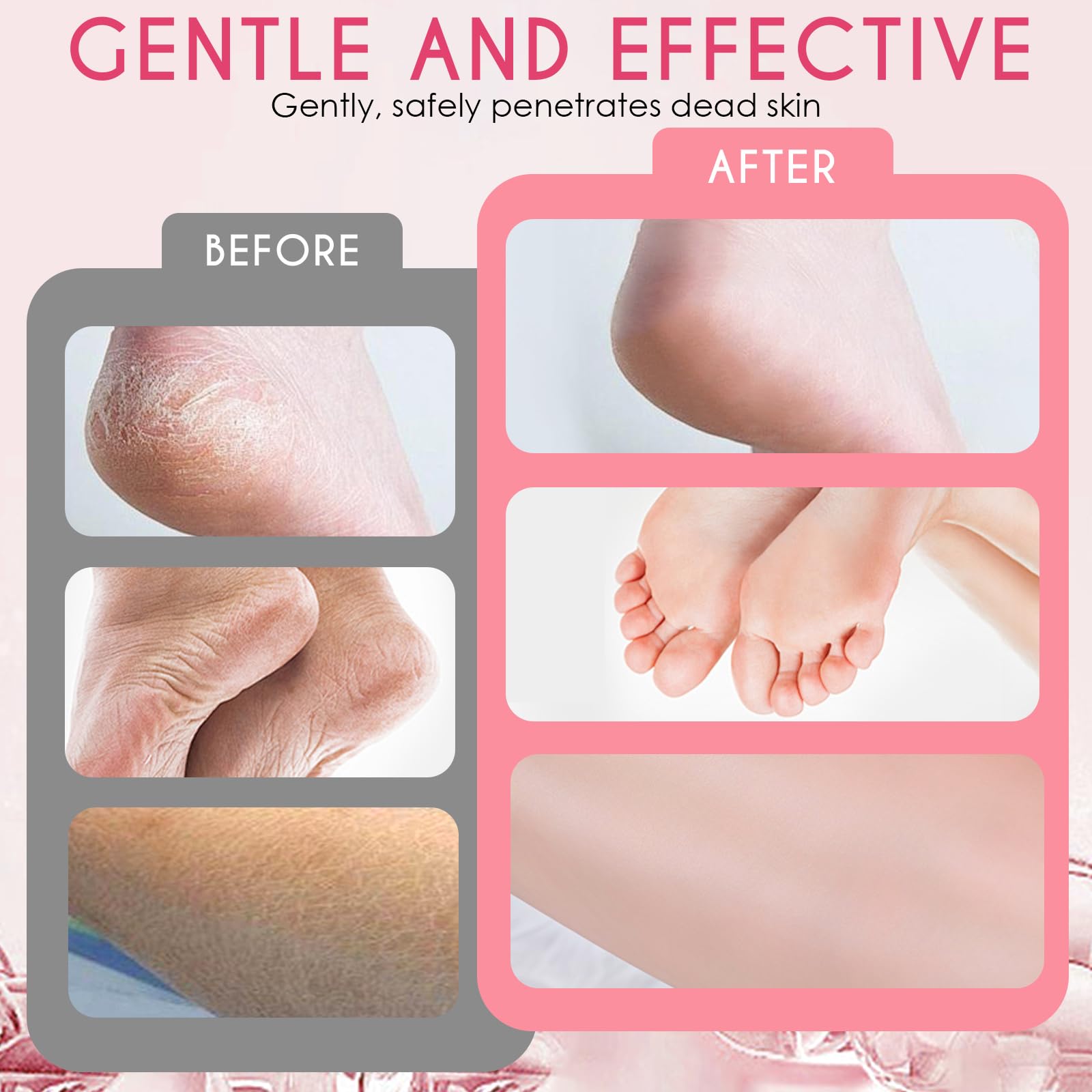 2 Paires Masque Pied Peeling, Hornhaut Entfernung Fuß Peeling Maske, Hydratantes, Pieds Nourrissant pour les Pieds, Soin Réparateur pour Hommes et Femmes (strawberry + papaya)