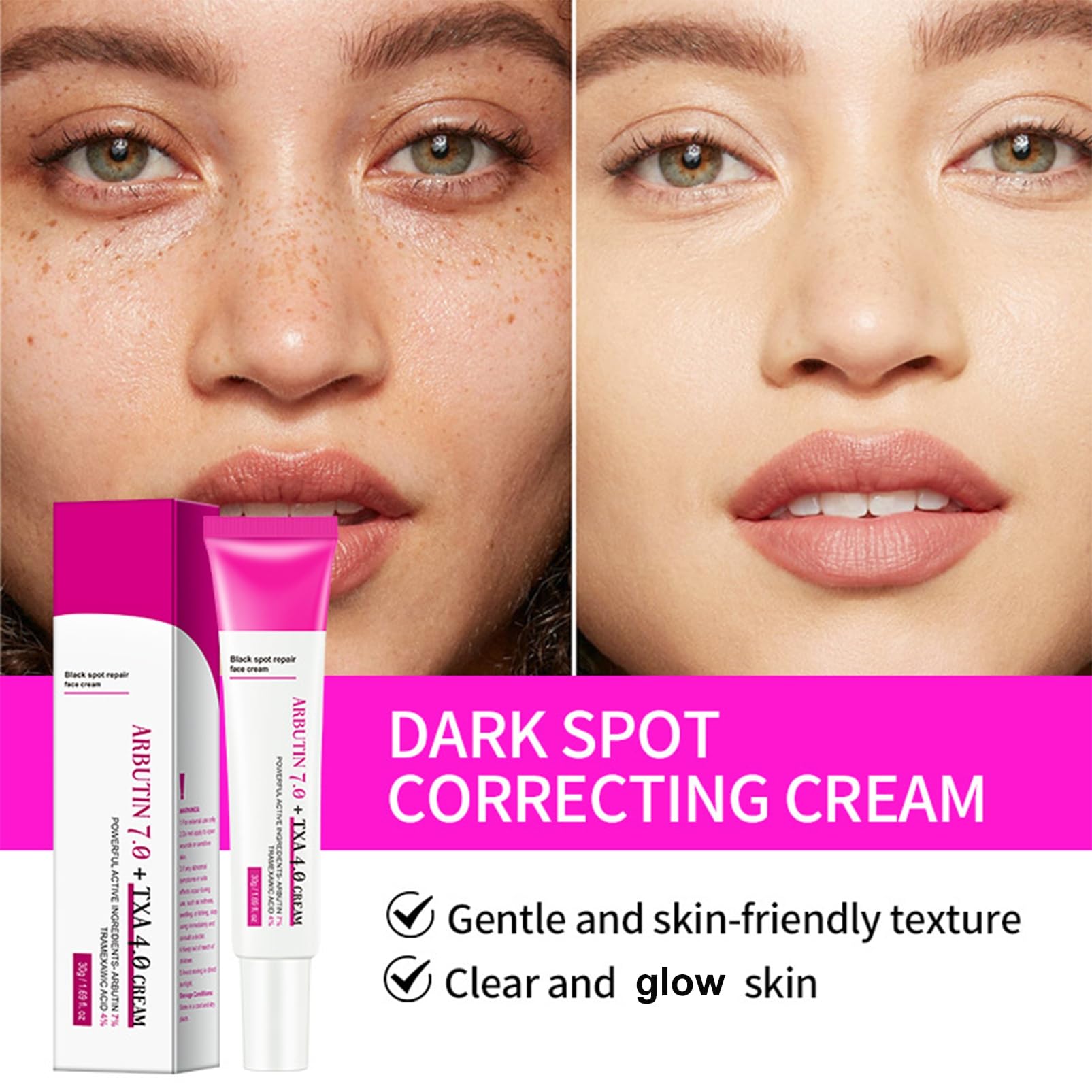 Arbutin 7% + ácido tranexámico 4% crema – Dark Spot Remover Skin Lightening Cream, Eliminador de manchas de pigmentación facial – Crema Glow Skin contra manchas de pigmento, pecas e imperfecciones - 3
