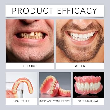 Advanced Customized Full Den/ture Set,Clip in Veneers Teeth Top and Bottom Set,Silicone Reline Dent/ure Se/t,Adjustable Snap-On De/ntures for Missing Te/ETH,Easy-Fit Clip in Teeth Veneers,Comfortable