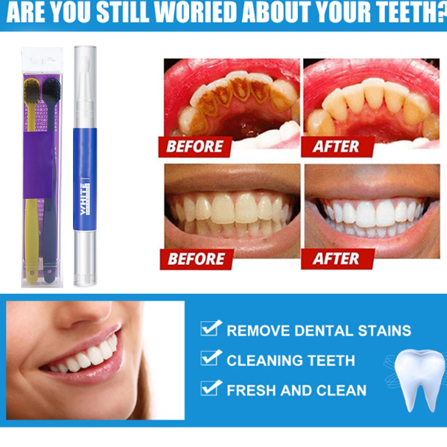 BLEEX Sérum Blanchissant Stylo, Le Stylo Blanchisseur Bleex, Gel Blanchiment Dentaire, éclaircit Instantanement, élimine Les Taches & Jaunissement, Pour Dents Sensibles, Facile à Appliquer (5)