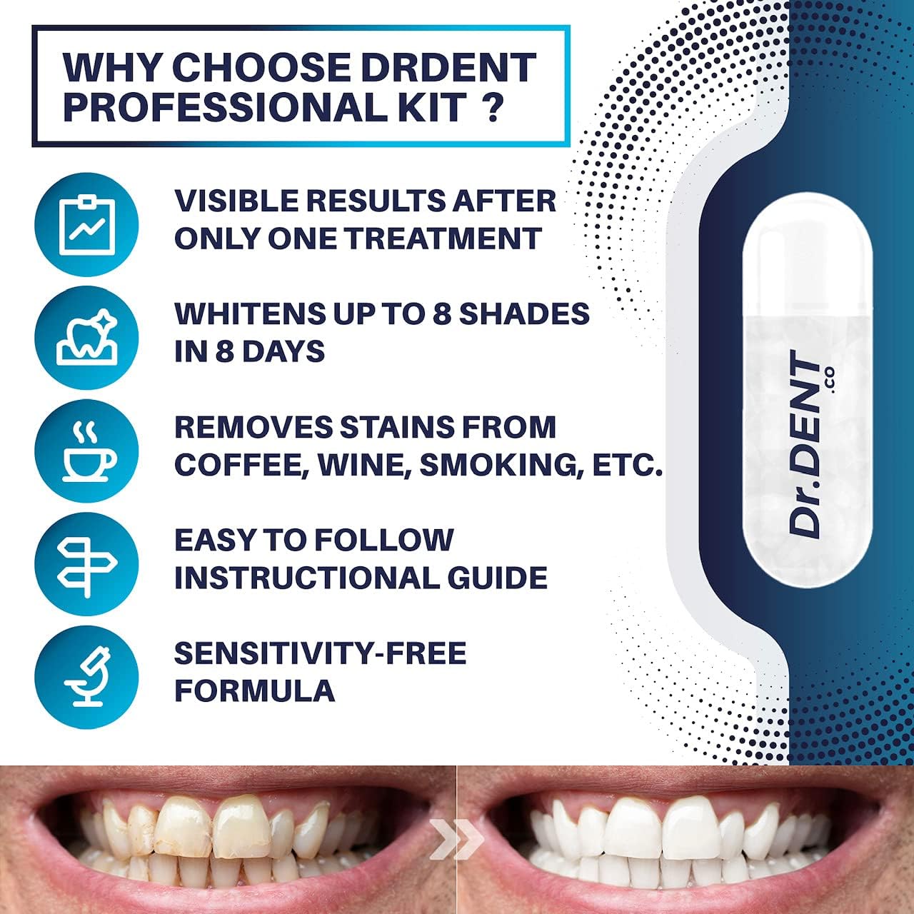 DrDent Professional LED Teeth Whitening Kit Sensitivity Free Formula