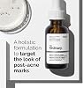 Colección para Piel Sensible de The Ordinary, Set de Cuidado de la Piel para Piel con Imperfecciones, Limpiador Espumoso con Glucósido, Solución de Aloe 2% + NAG 2%, Niacinamida 10% + Zinc 1%, Factores de Hidratación Naturales + Beta Glucano 7