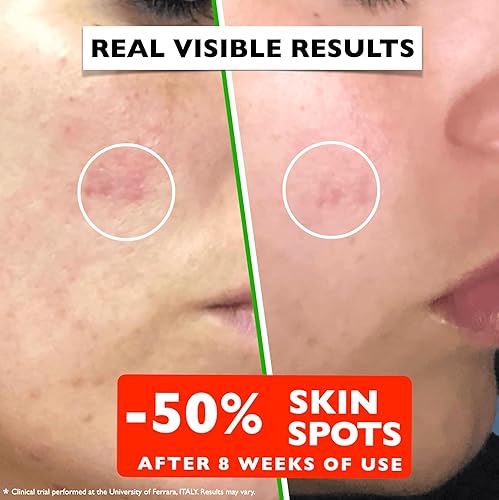 Miniatura 4 de Suero de vitamina C para la cara Suero facial antienvejecimiento con vitamina C, ácido hialurónico, vitamina E. Fórmula iluminadora. Mejora la