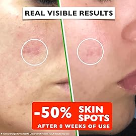 Vitamin C Serum For Face - Anti Aging Face Serum with Vitamin C, Hyaluronic Acid, Vitamin E. Brightening Formula. Improve Appearance of Dark Spots, Tone, Fine Lines & Wrinkles, Glowing Skin 2 Fl Oz