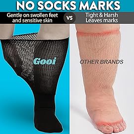 Gooi Extra Wide Socks for Swollen Feet Soft Stretch to 30 Seniors Diabetics Men Women 10-13 13-15 Non Binding Loose Fit Top Edema Lymphedema Neuropathy Bariatric Cover Cast Over The Calf Plus Size