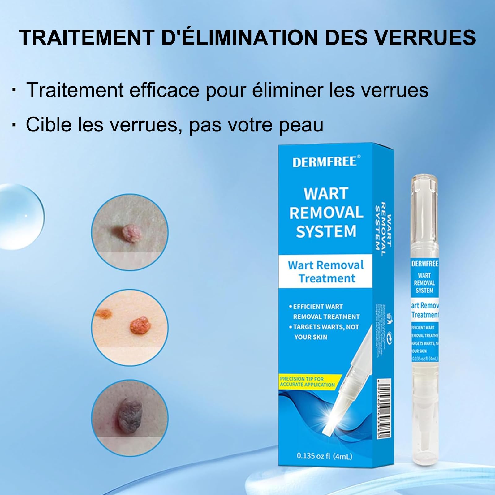Crème D'élimination des Verrue Plantaire, Stylo anti-verrues 4ML