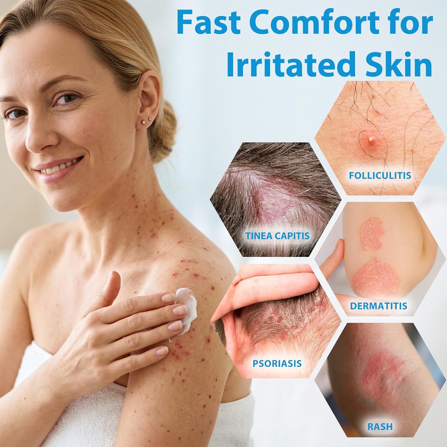 Arkturi Folliculitis Cream, Folliculitis & Acne Care Cream, Effective Care for Folliculitis Scalp Face and Body 120ml