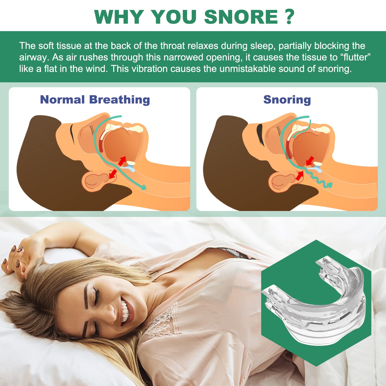 anti-snore device snoring solution mouthpiece anti-snoring mouth guard for men and women sleep-ma11