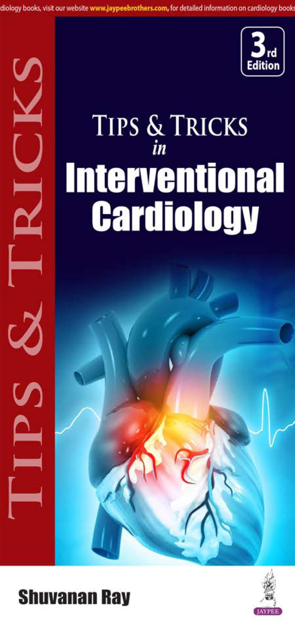 Tips and Tricks in Interventional Cardiology by Shuvanan Ray