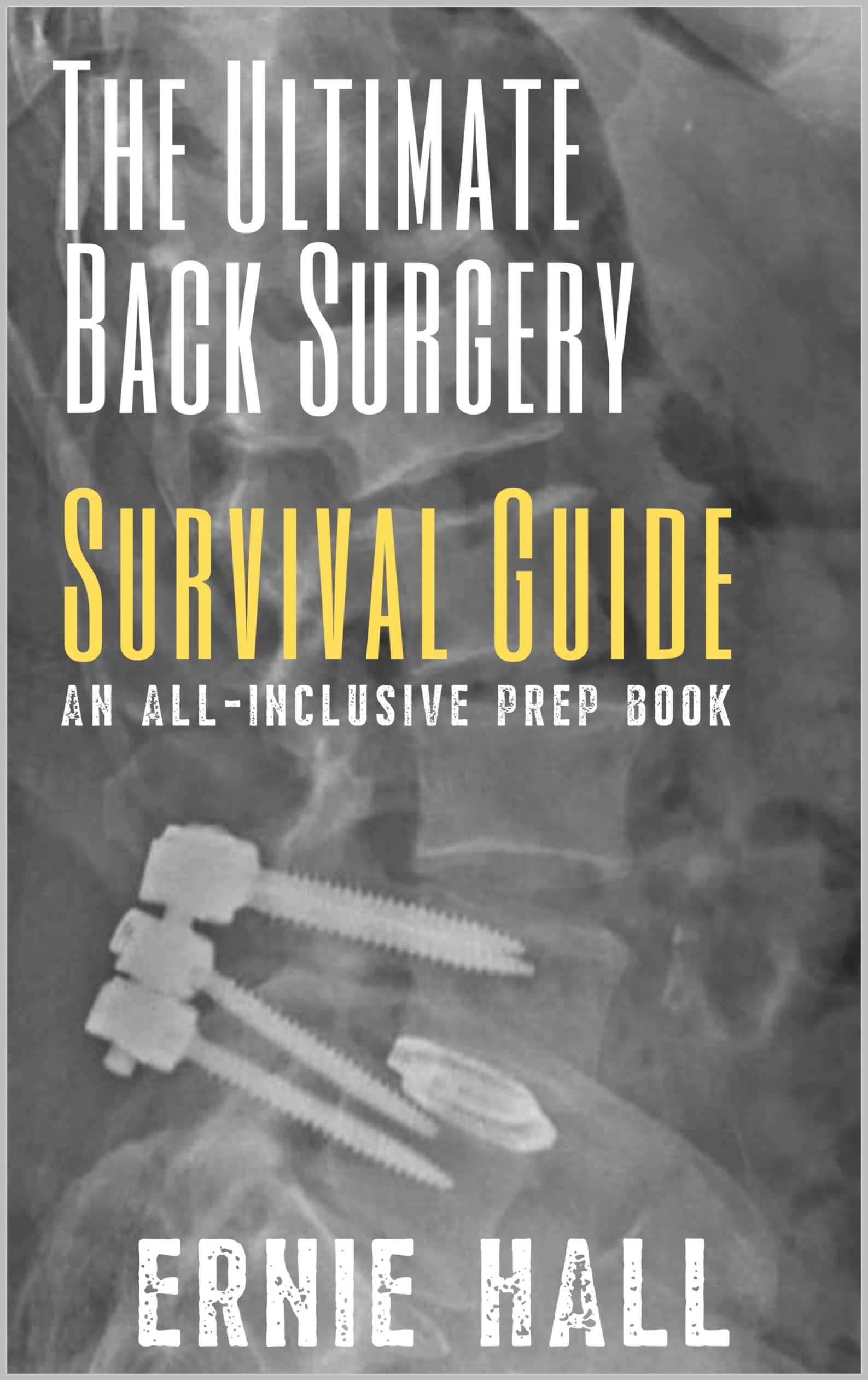 The Ultimate Back Surgery Survival Guide: An All-Inclusive Prep Book
