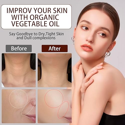 Miniatura 5 de Aceite orgánico de semillas de rosa mosqueta, aceites esenciales para antienvejecimiento, 100% puro prensado en frío, todo natural, relajante y