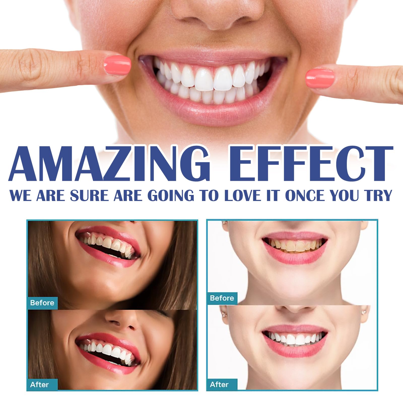 Gel de tratamiento instantáneo de goma, gel, gel de encía, gel de tratamiento instantáneo de encías, gel de terapia de encías Dentizen (3 piezas)
