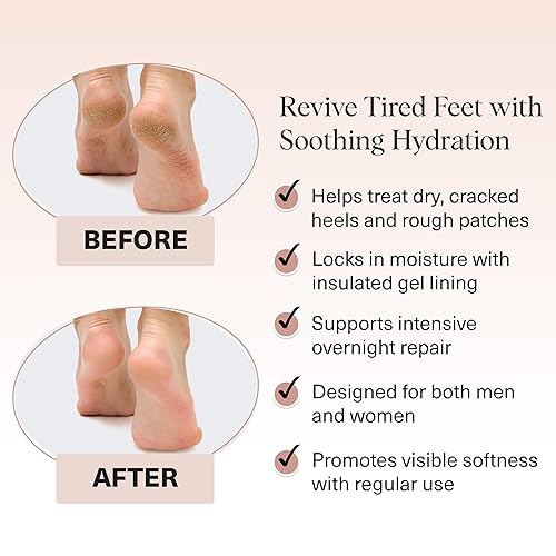 Miniatura 3 de Kitsch - Calcetines hidratantes para tratamiento de talones agrietados  Calcetines de spa reutilizables para mujeres y hombres con forro de gel