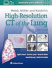 Webb, Müller and Naidich's High-Resolution CT of the Lung