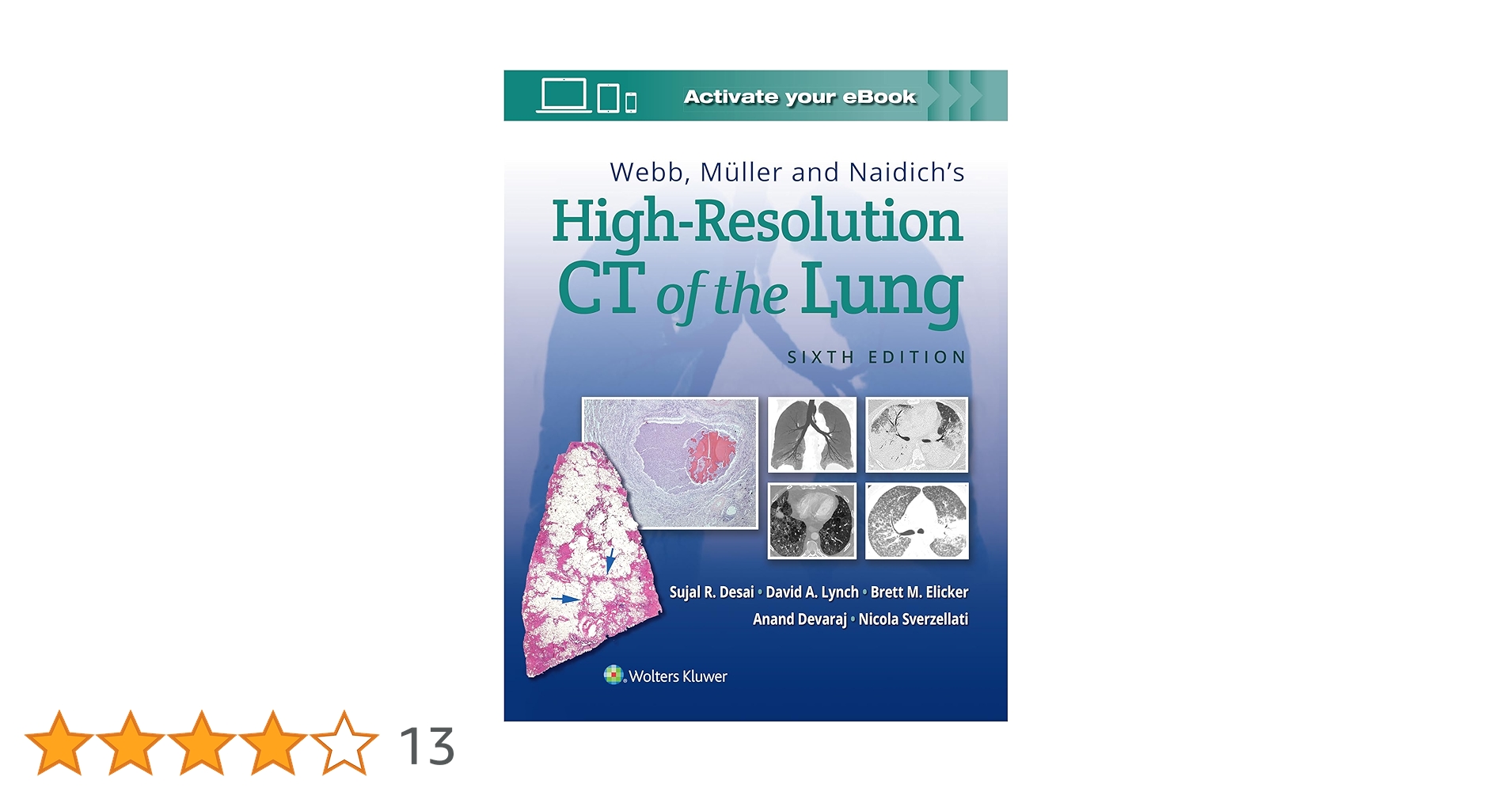 Buy Webb, Müller and Naidich's High-Resolution CT of the Lung Book