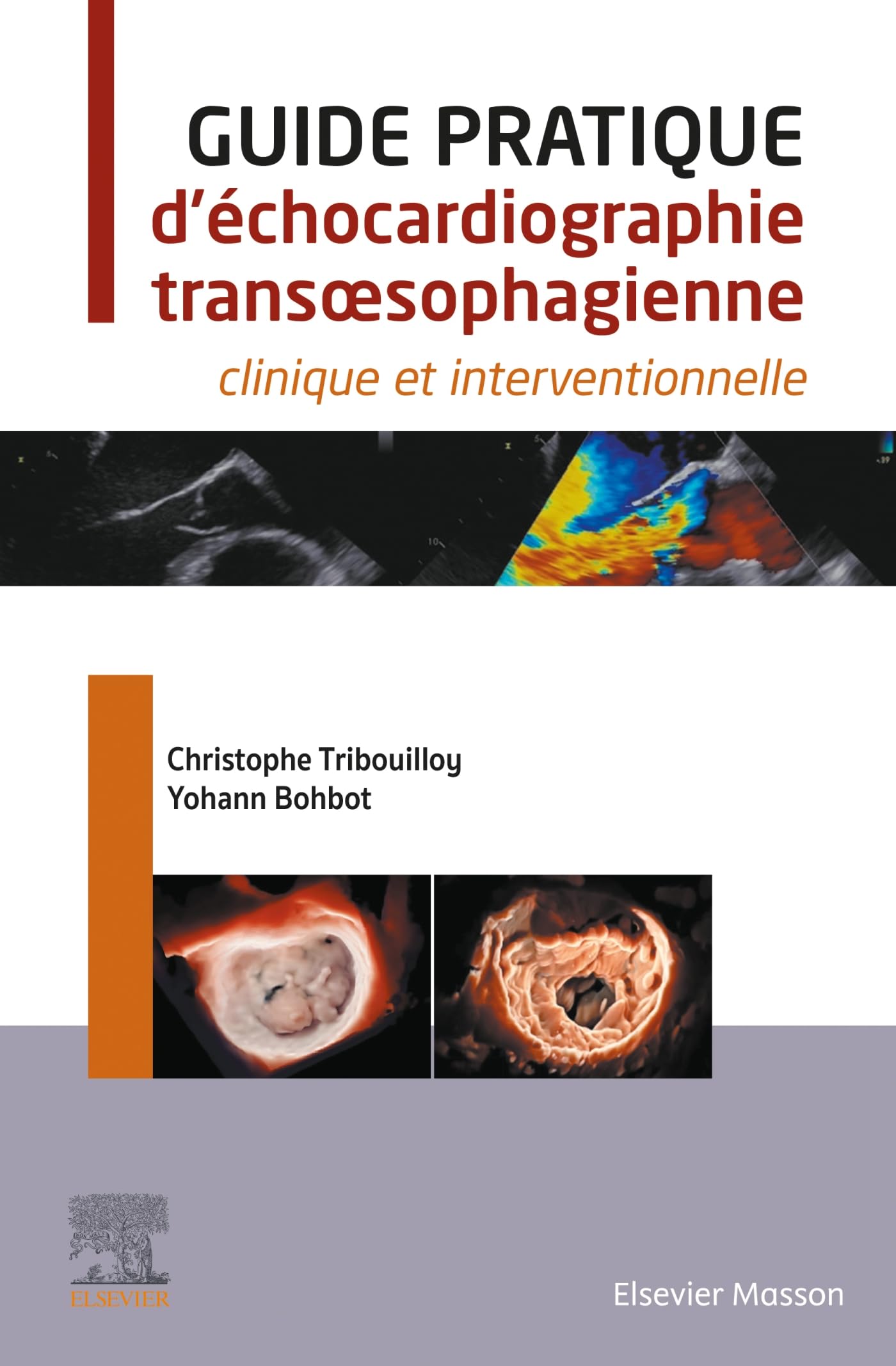 Guide pratique d'échocardiographie transoesophagienne: clinique et interventionnelle