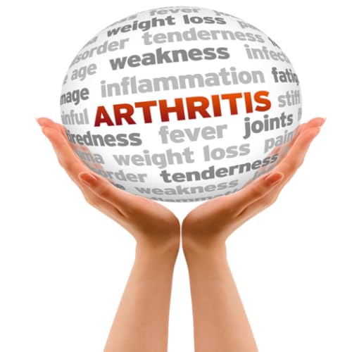 Arthritis Treatment : Natural Arthritis Treatment: Discover 10 Ways To Instantly Relieve Arthritis Stiffness And Pain
