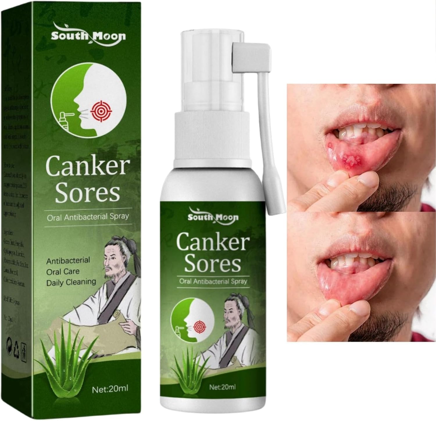 Ulcer Breath Sprays,Mouth Ulcer Treatment Spray,Mouth Ulcer Spray,Oral
