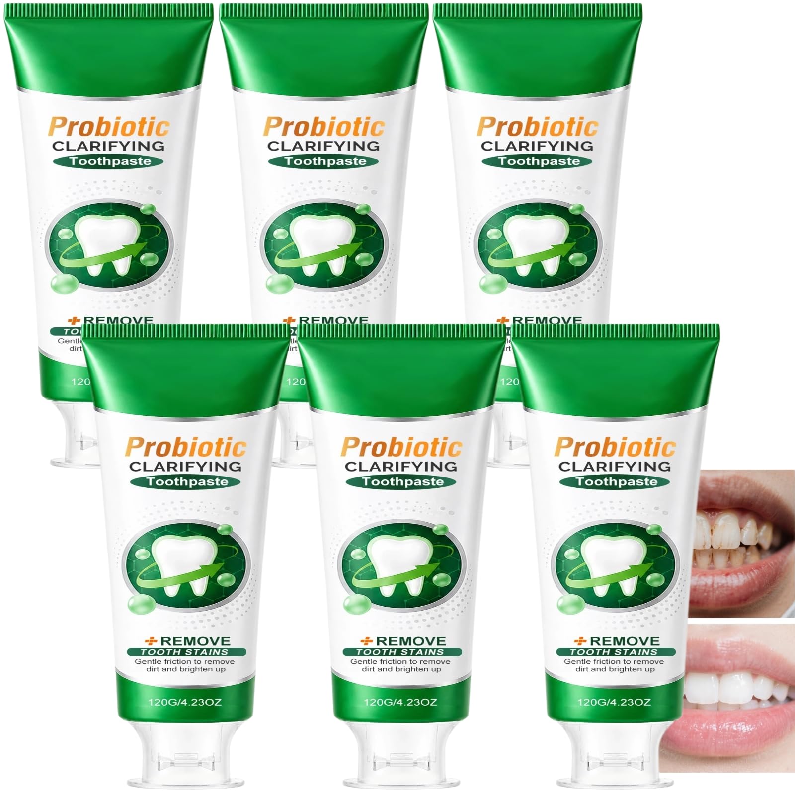 Dentifrice Eappy - Dentifrice blanchissant à l'hydroxyapatite pour une réparation douce de l'émail, aide à éliminer les taches de thé et de café, haleine fraîche à la menthe, soin (6pcs)