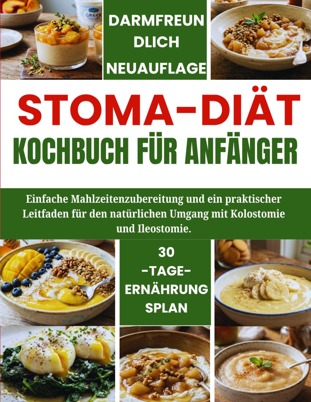 Stoma-Diät-Kochbuch für Anfänger: Einfache Mahlzeitenzubereitung und ein praktischer Leitfaden für den natürlichen Umgang mit Kolostomie und Ileostomie.