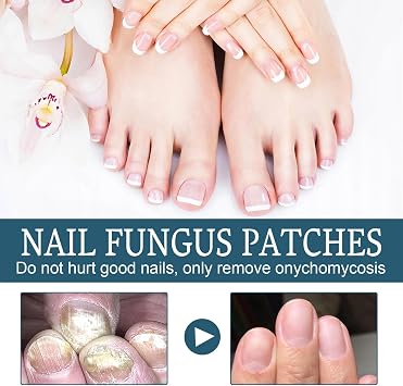 Extra Strong Nail Fungal Treatment for Toenail & Fingernail, Antifungal Nail Repair Solution to Strengthen, Revitalize Damaged, Broken & Discolored Nails, 30ml