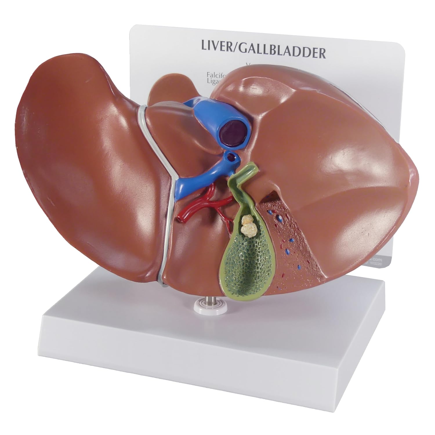 GPI Anatomicals - Liver and Gallbladder Model, Replica of Digestive System with Gallstones for Human Anatomy and Physiology Education, Anatomy Model for Doctor's Office, Medical Learning Resources