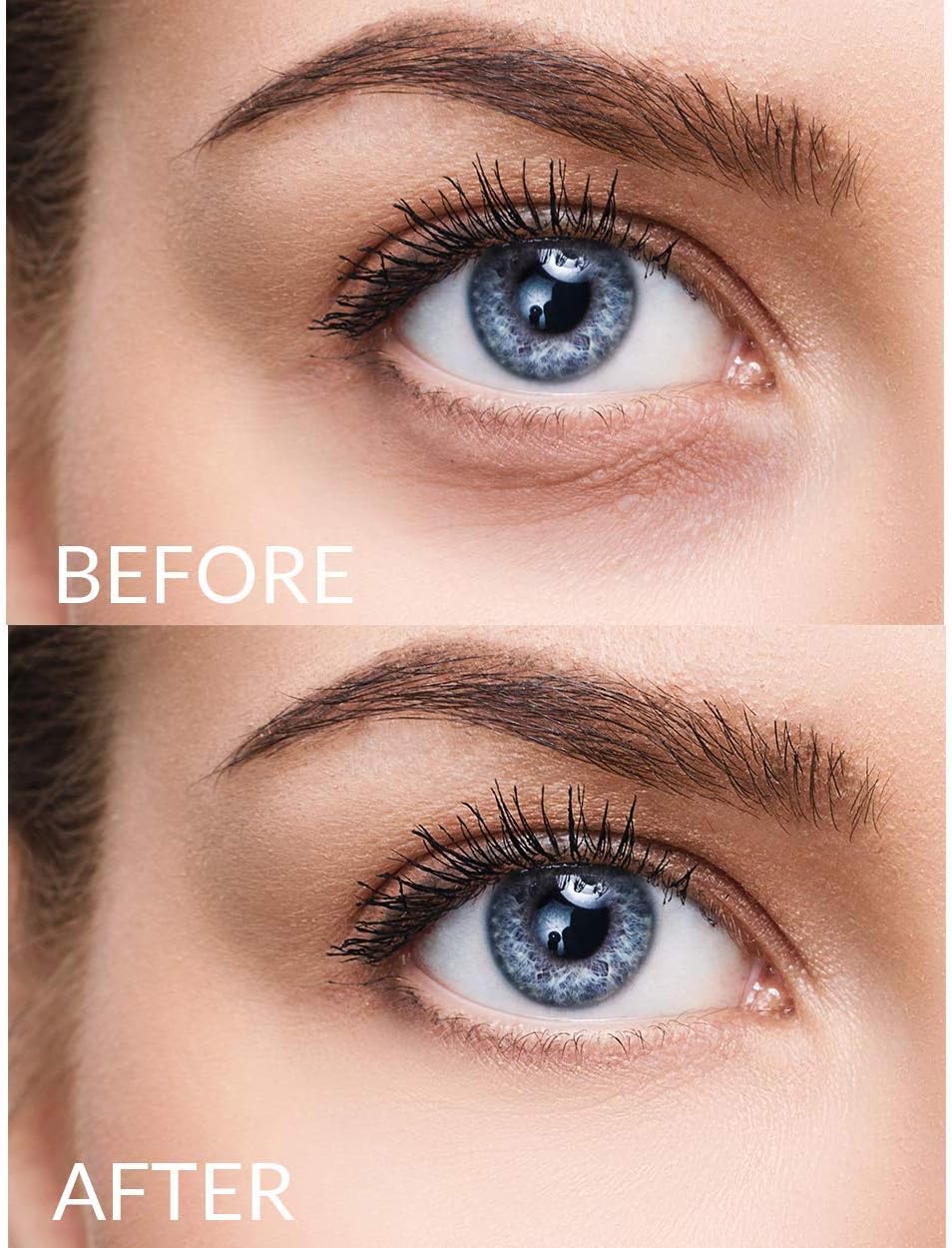 Vasanti Eye Wonder 2.0 - Super Powered Eye Cream with Ceramic Tip - Removes Dark Circles Wrinkles Anti-Aging Eye Treatment Cream - Image 3