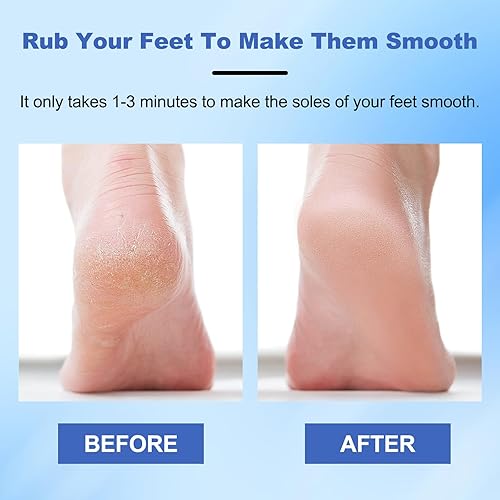 Miniatura 3 de Lima de pie Veinsgrain, lima de pie de nano vidrio, removedor de piel dura, lima de pie de nano-vidrio, lima de pies de grano de venas, herramientas