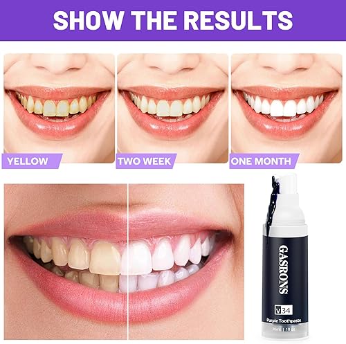 Miniatura 4 de Pasta de dientes morada, Blanqueamiento de dientes púrpura, Eliminación de manchas de dientes, Retiro de Blanqueamiento de Dientes, Potenciador de
