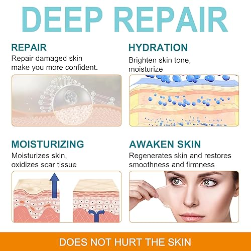 Miniatura 2 de Hojas de silicona para cicatrices (rollo de 1.6 x 150 pulgadas, rollo de 1.6 in x 12.5 ft), tiras de silicona para cicatrices, rollo de cinta de