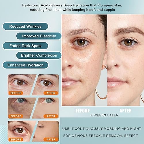 Miniatura 5 de Suero de vitamina C para la cara con ácido hialurónico y péptidos, suero facial antienvejecimiento para mujeres y hombres, corrector de manchas