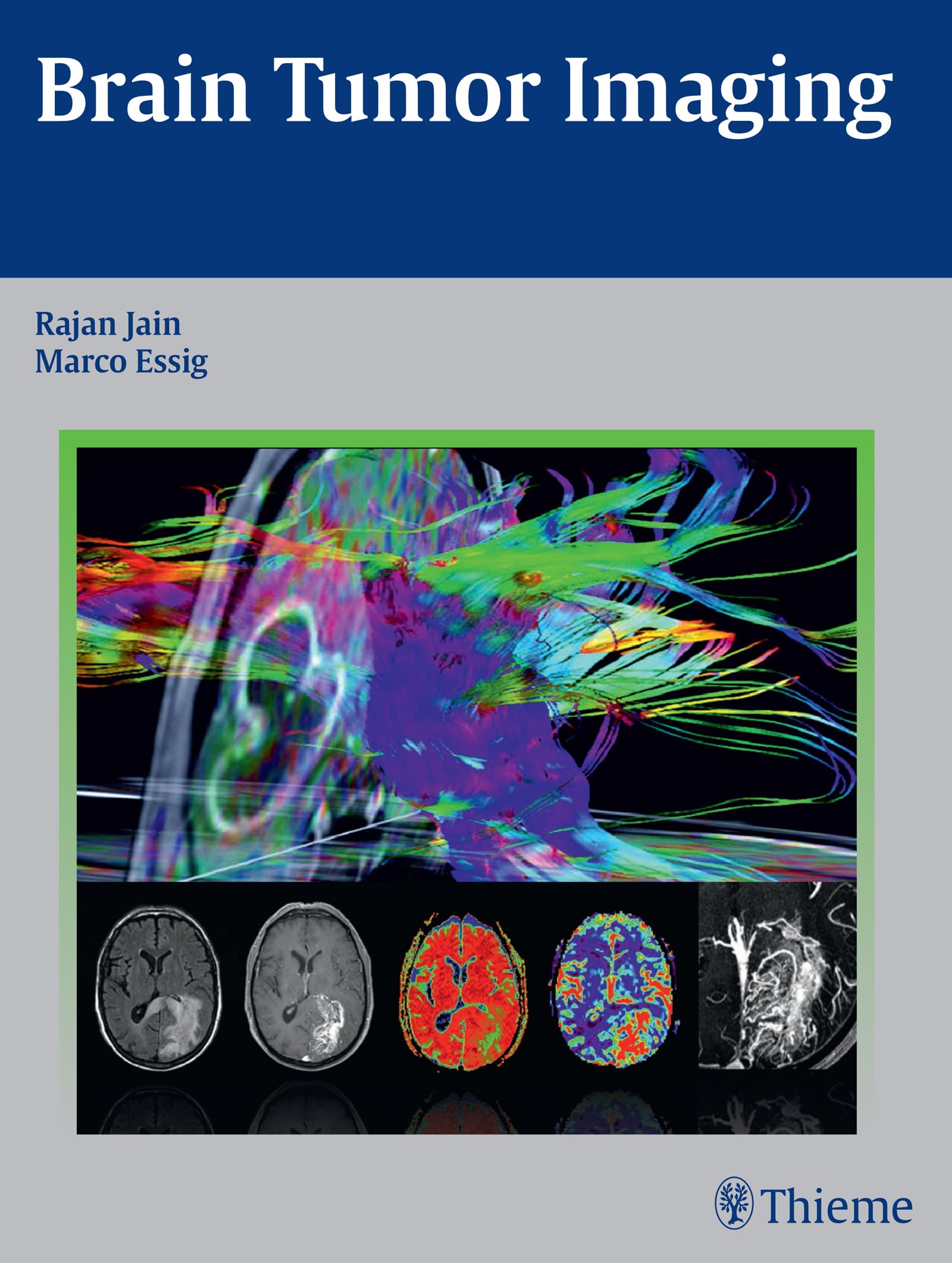 Brain/Update 田仲真治 治療DVD USED The New Change Your Brain, Change Your Pain: Based on EMDR