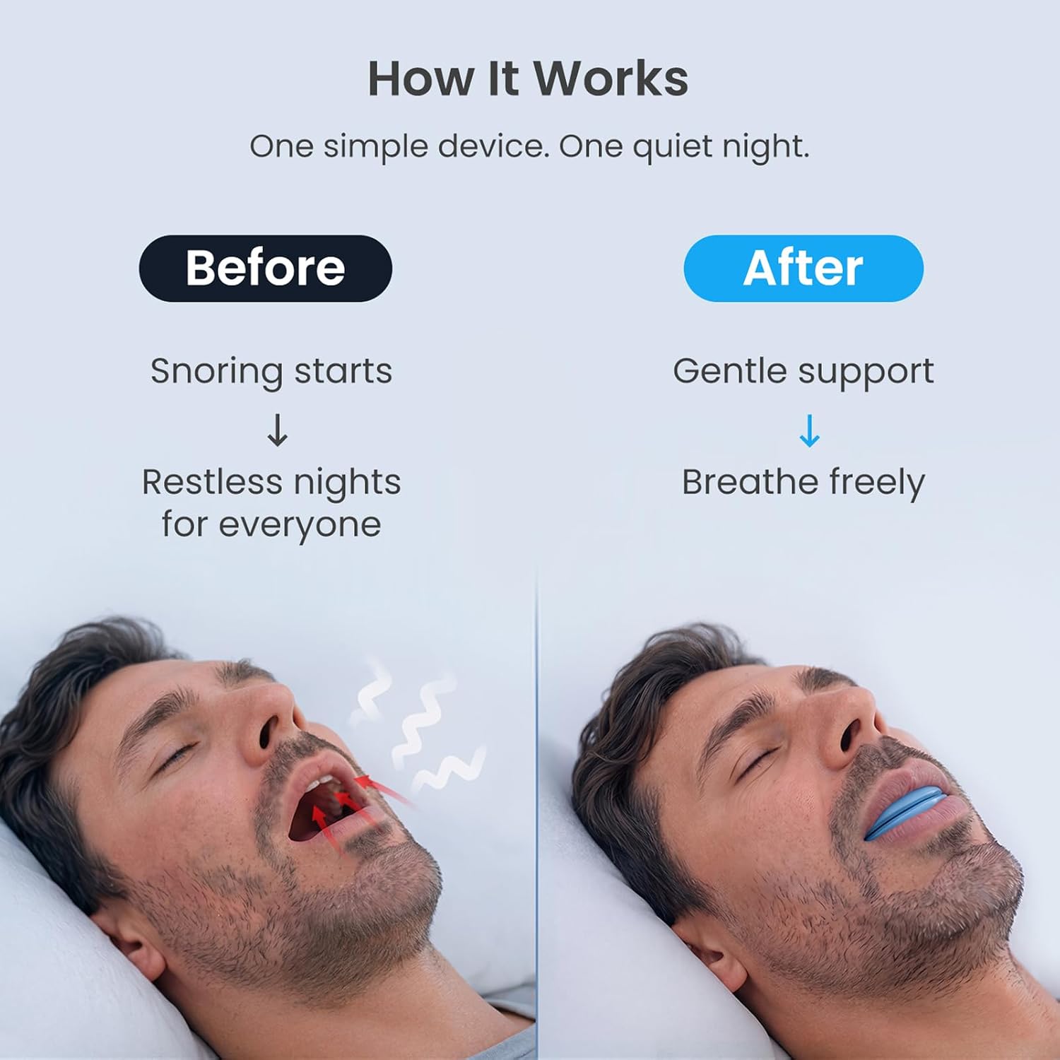 Anti Snore Mouthpiece - FDA-Registered Snoring Aid - Food-Grade Silicone - Boil & Bite Custom Fit Snoring Relief - Reusable with Storage Case - Helps Reduce Snoring for Quieter Nights (Blue)