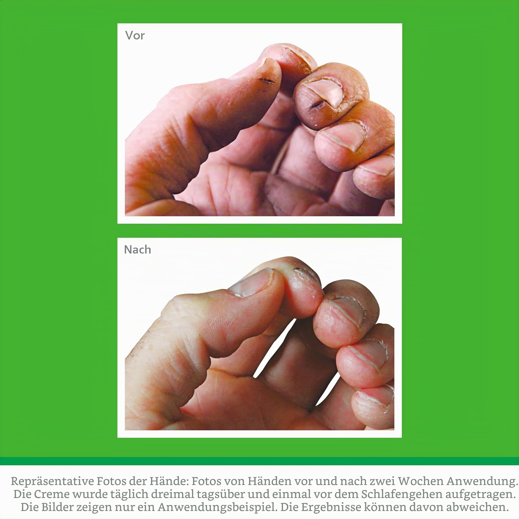 O'Keeffe's Working Hands, 96 g Glas (6er-Pack) – Handcreme für extrem trockene, rissige Hände, steigert sofort den Feuchtigkeitsgehalt, schafft eine Schutzschicht und verhindert Feuchtigkeitsverlust