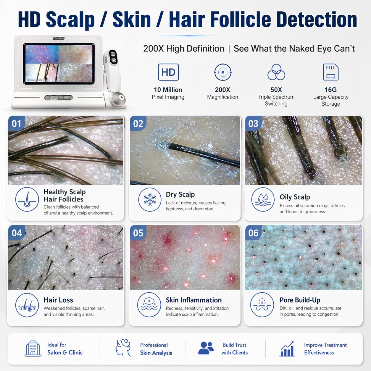 Analizador de diagnóstico de piel, 11 pulgadas, 50 x 200 x, tipo de carga digital, microscopio de cuero cabelludo, folículo piloso, detector de pelo de piel, máquina para el hogar, salón de belleza